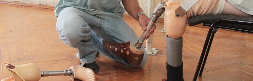 ساخت پروتز زیر زانو