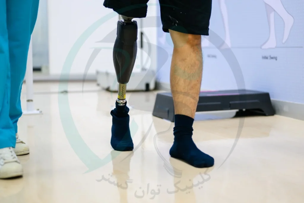 انتخاب پروتز پا